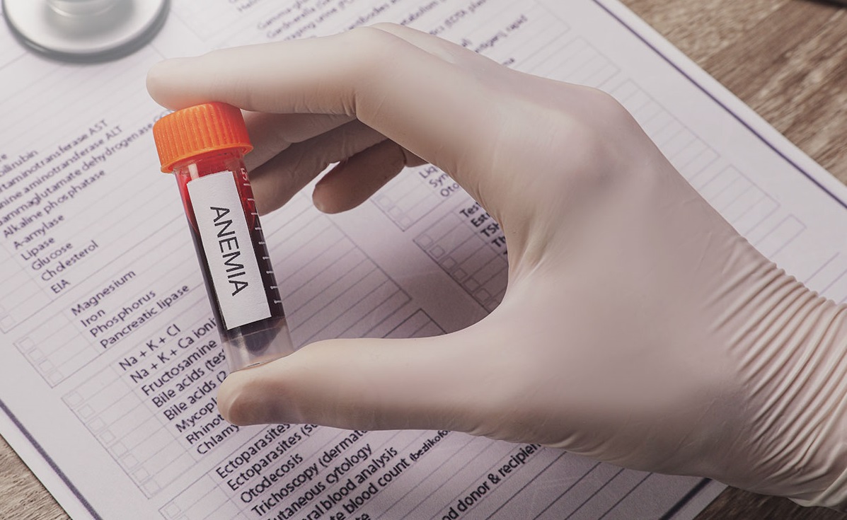 Understanding The Icd-10 Code For Anemia